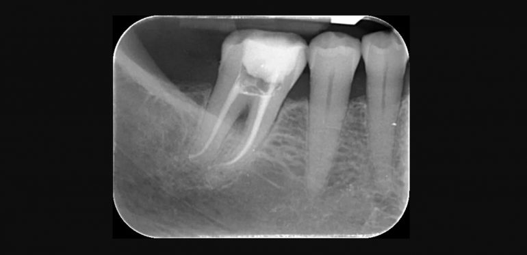 Endodonzia Art medica
